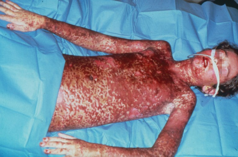 1048885-1062790-1418