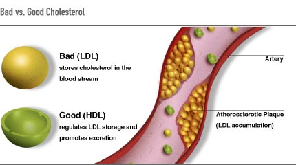cholesterol1