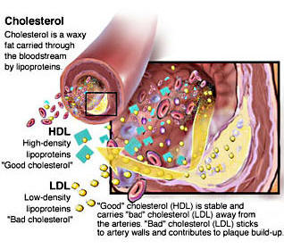 reduce-cholesterol